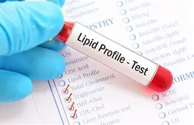 Lipid profile test at pathology lab - cholesterol and triglyceride analysis
